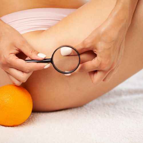 Image Title My Image